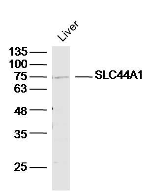SLC44A1溶质转运蛋白家族44成员1抗体