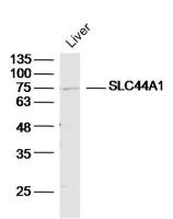 SLC44A1溶质转运蛋白家族44成员1抗体