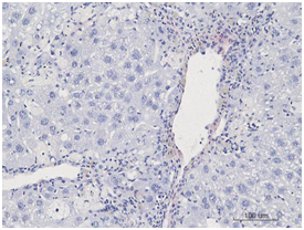 肝纤维化小鼠模型