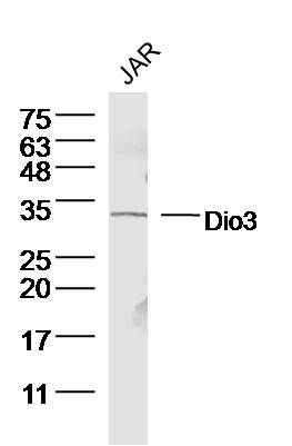 Dio3甲状腺素5'脱碘酶3抗体