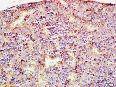 CYP17细胞色素P450 17抗体