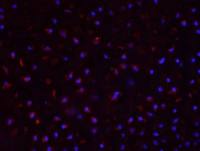 CYP11B1细胞色素P450 11B1抗体