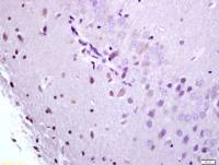 BMAL1芳香烃受体核转录蛋白样1抗体