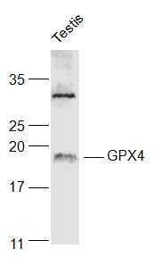 GPX4谷胱甘肽过氧化酶4抗体