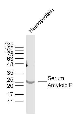 Serum Amyloid P血清淀粉样蛋白P成份抗体