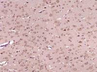 ATG4A自噬相关蛋白4A抗体