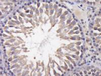 phospho-CBL2 (Tyr700)磷酸化原癌基因CBL2抗体