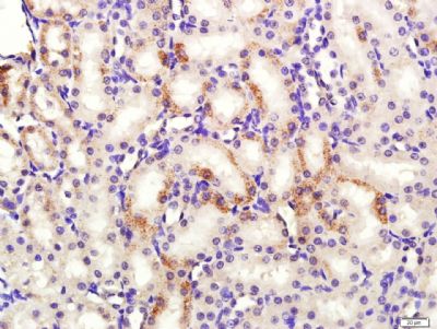 HSD3B1滋养层细胞抗原3β-HSD抗体