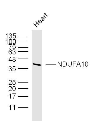 NDUFA10 NADH氧化还原酶辅酶10抗体