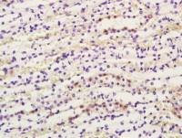 COX1/MTCO1细胞色素c氧化酶1抗体