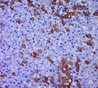 Pancreatic Amylase胰淀粉酶抗体