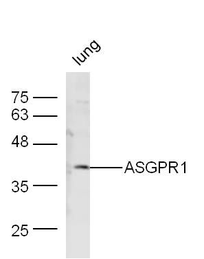 ASGPR1唾液酸糖蛋白受体1抗体