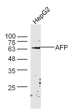 AFP甲胎蛋白AFP抗体