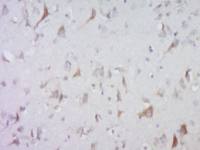 testis antigen 1B肿瘤/睾丸抗原1B/1A