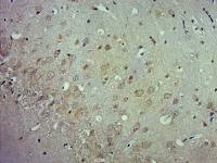 sLOX 1可溶性凝集素样氧化低密度脂蛋白受体1抗体