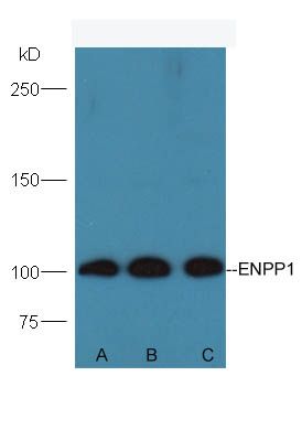 ENPP1核苷酸内焦磷酸酶/磷酸二酯酶1抗体