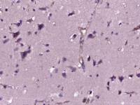 WISP2结缔组织生长因子样蛋白抗体