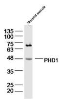 PHD1脯氨酰羟化酶抗体