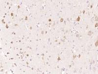 p53R2核苷酸还原酶M2B抗体