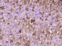 SOAT2胆固醇酰基转移酶2抗体