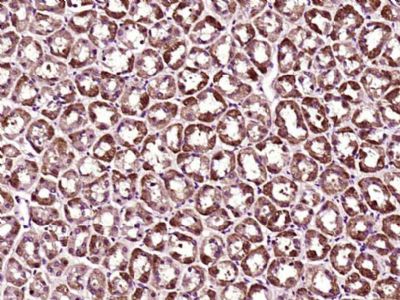 MACC1结肠癌转移相关蛋白1抗体