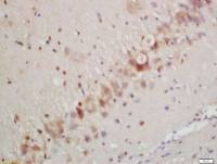 Beta tubulin 微管蛋白β tubulin/Tubulin β抗体