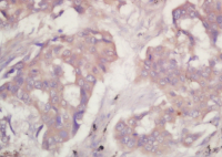 丙酮酸激酶-M2抗体PKM2