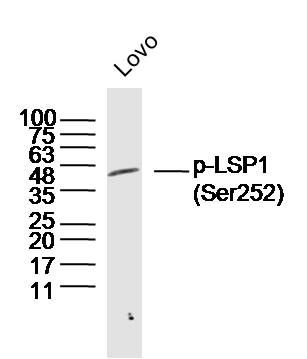 phospho-LSP1 (Ser252)磷酸化白细胞F肌动蛋白结合蛋白抗体