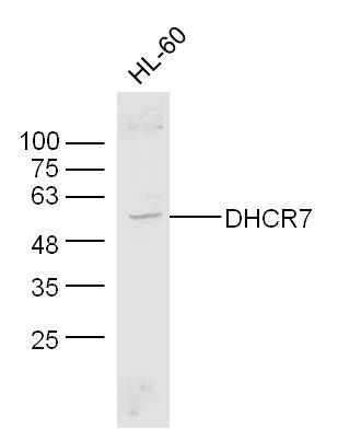 DHCR7脱氢胆固醇还原酶7抗体