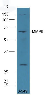 MMP9基质金属蛋白酶9抗体