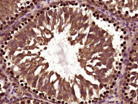 配对盒基因3抗体PAX3
