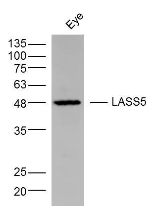 LASS5长寿相关基因lASS5抗体