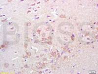 Synaptotagmin 1突触结合蛋白1抗体