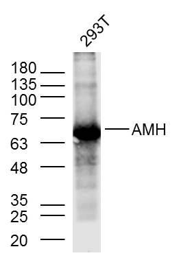 AMH Muellerian缪勒管激素抑制因子抗体