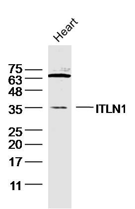 ITLN1内皮细胞凝集素HL1抗体