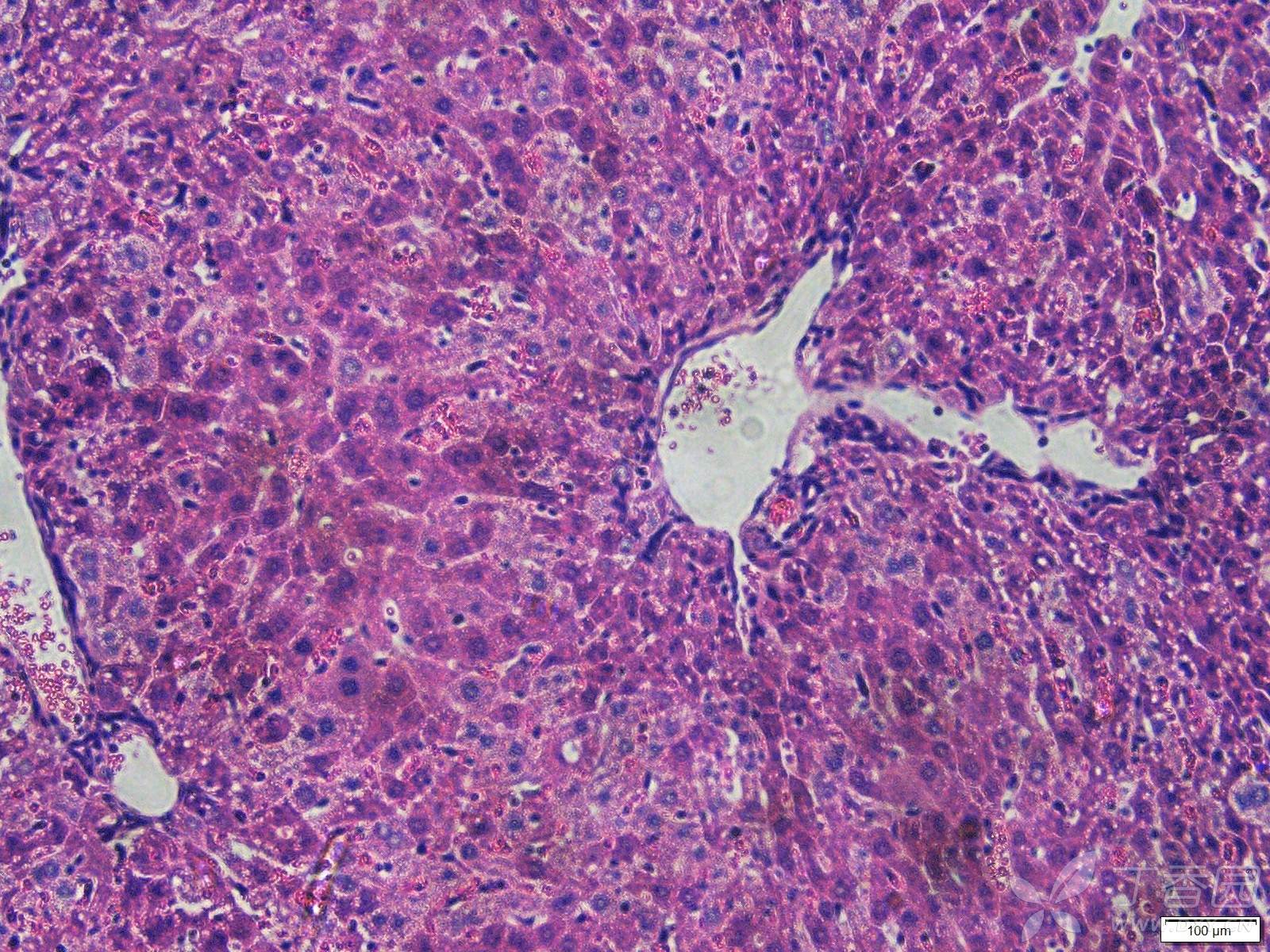 小鼠肝臟he染色病理切片分析