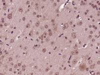 Apolipoprotein A V载脂蛋白A5抗体