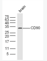 扑克蒙蛋白抗体