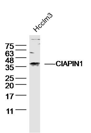 CIAPIN1细胞因子诱导凋亡抑制因子1