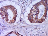 phospho-CDKN1A/p21 (Ser146)磷酸化p21蛋白抗体