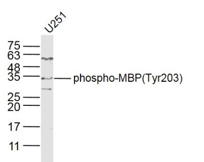 phospho-MBP(Tyr203)磷酸化髓鞘碱性蛋白抗体