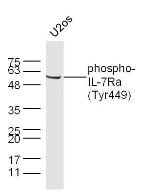 phospho-IL-7Ra (Tyr449)磷酸化白细胞介素-7受体a抗体