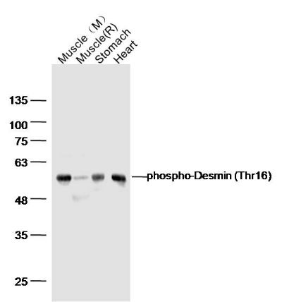 phospho-Desmin (Thr16)磷酸化结蛋白抗体