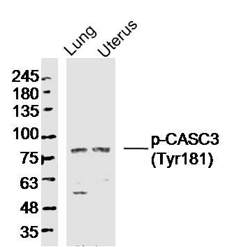 phospho-CASC3(Tyr181)磷酸化肿瘤易感候选基因3抗体