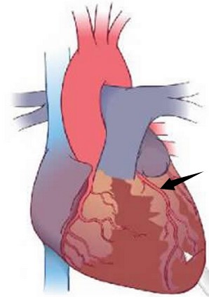 大鼠/小鼠心肌梗死（心梗）模型服务
