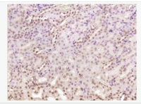 色氨酸羟化酶抗体TPH