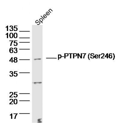 phospho-PTPN7 (Ser246)磷酸化非受体型蛋白酪氨酸磷酸酶7抗体