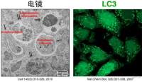 自噬共聚焦（confocal）成像拍照服务