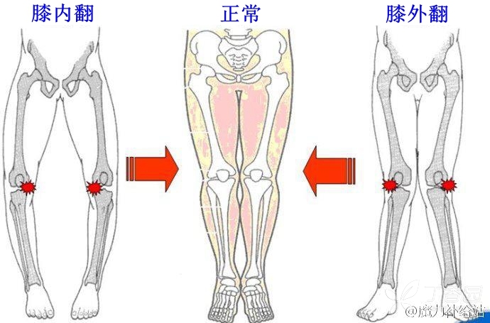 疼痛影像二三事系列之三