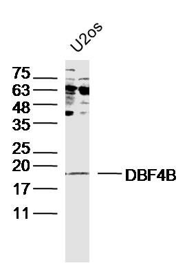 DBF4B S期激酶活化蛋白DBF4B抗体